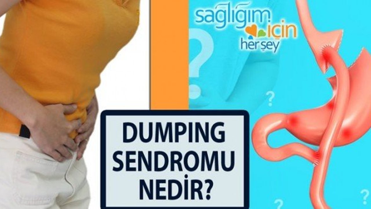 Dumping sendromu nedir nasıl olunur? Dumping sendromu iyileşir mi?