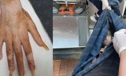 Türkiye'yi Şoke Eden Olayda Çöp Eve Giren İşçiler Detayları Anlattı!