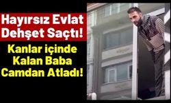 Madde Bağımlısı Oğlu Tarafından Bıçaklanan Adam Pencereden Atlayarak Kurtuldu!
