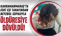 Kahramanmaraş'ta Eski Koca Şiddeti: Kafasına 30 Dikiş Atıldı!