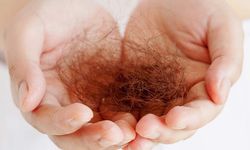 Saç Dökülmelerine Doğal Yöntemler: Saç Sağlığınızı Destekleyin