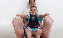 Dünyanın En Büyük Ayağına Sahip İnsanı Venezuelalı Jeison Orlando Rodriguez Hernandez’in ayakkabı numarası kaçtır?