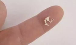 İnsan Vücudundaki En Küçük ve En Hafif Kemik Hangisidir? İşte Cevabı