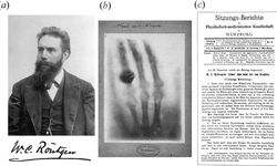 Bilim Tarihini Değiştiren Kare: İlk Röntgen Fotoğrafı ve Hikayesi