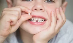 Çocuklarda Süt Dişleri Kaç Tanedir? Diş Gelişim Rehberi