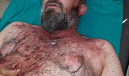 Kahramanmaraş Fırnız'da gurbetçi aileye saldırı: 12 yaralı, 12 gözaltı