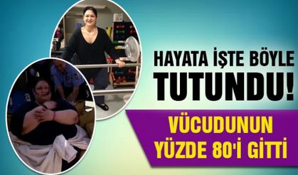 Hayata işte böyle tutundu! Vücudunun yüzde 80'i gitti