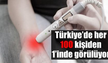 Prof. Dr. Seval Pehlevan, Türkiye’de her 100 kişiden 1’inde görüldüğünü açıkladı!