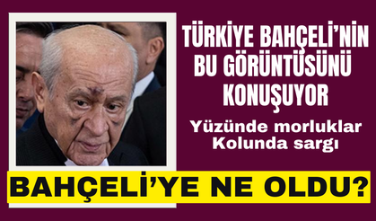 Bahçeli kaza mı geçirdi? Devlet Bahçeli'nin yüzündeki morluklar ve kolundaki sargı merak uyandırdı!