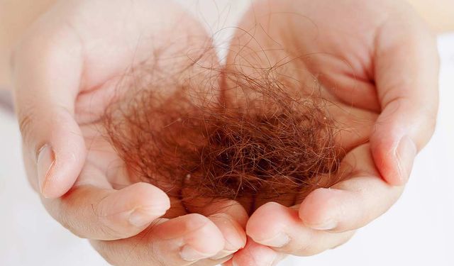 Saç Dökülmelerine Doğal Yöntemler: Saç Sağlığınızı Destekleyin