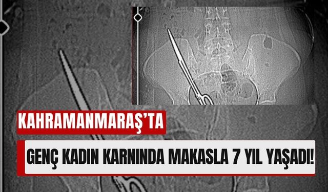 Kahramanmaraş’ta Tıbbi İhmal Şoku: 7 Yıl Karnında Makasla Yaşadı!