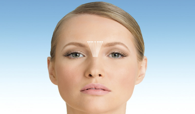 Glabella nedir? İnsan vücudunda glabella nerededir?