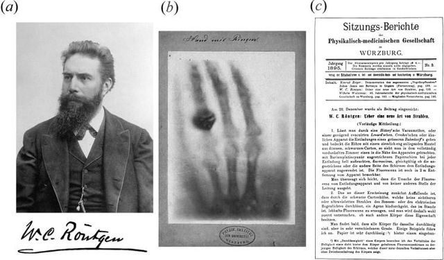 Bilim Tarihini Değiştiren Kare: İlk Röntgen Fotoğrafı ve Hikayesi