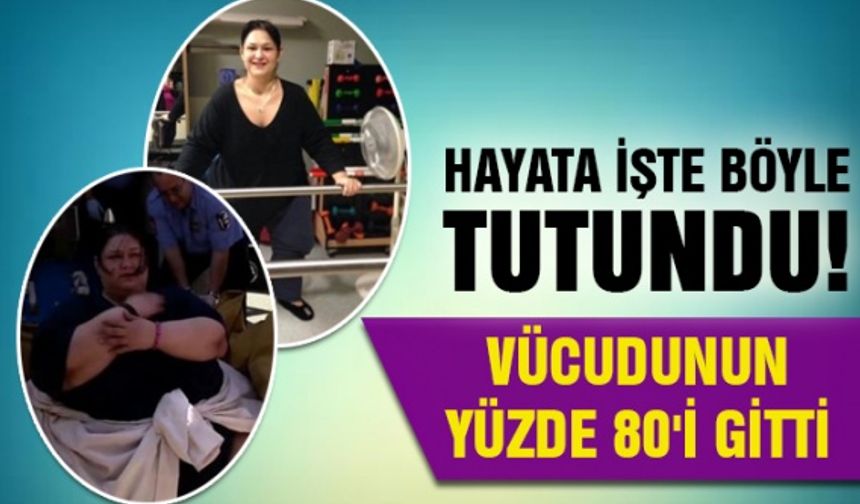 Hayata işte böyle tutundu! Vücudunun yüzde 80'i gitti