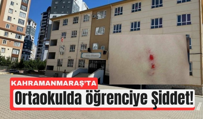 Kahramanmaraş’ta Okulda Şiddet: Öğrenci Sırtından Yaralandı