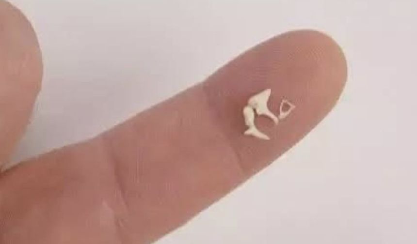 İnsan Vücudundaki En Küçük ve En Hafif Kemik Hangisidir? İşte Cevabı