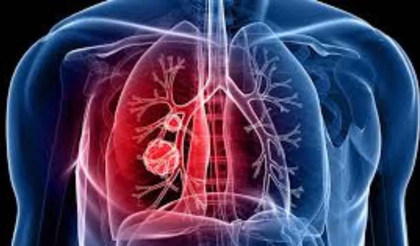 Dünya nüfusunun yaklaşık üçte biri hangi hastalığın gizli taşıyıcısıdır?